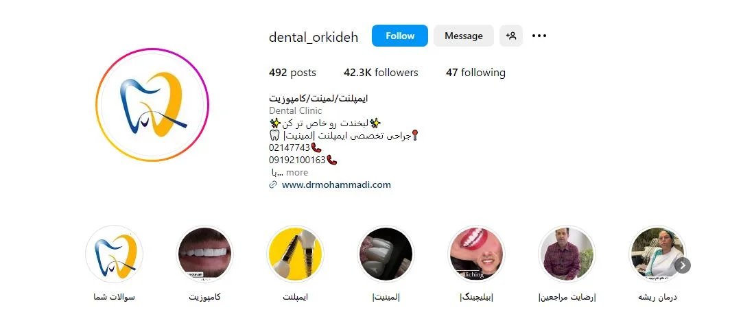 لمینت دندان قسطی در تهران