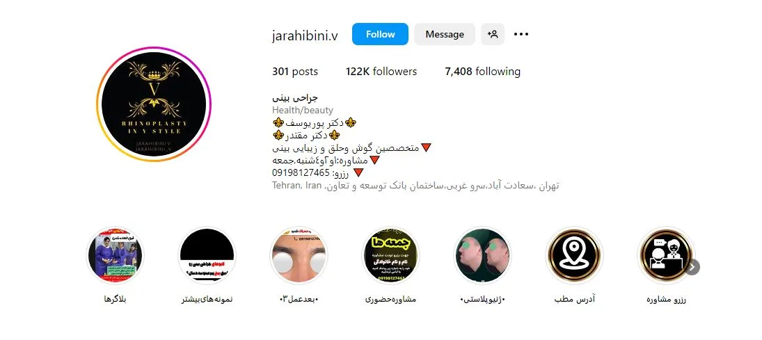 جراحی بینی قسطی تهران