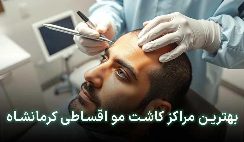 4 تا از بهترین مراکز کاشت مو اقساطی در کرمانشاه + آدرس ، تلفن تماس