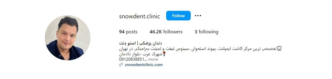 ایمپلنت قسطی تهران