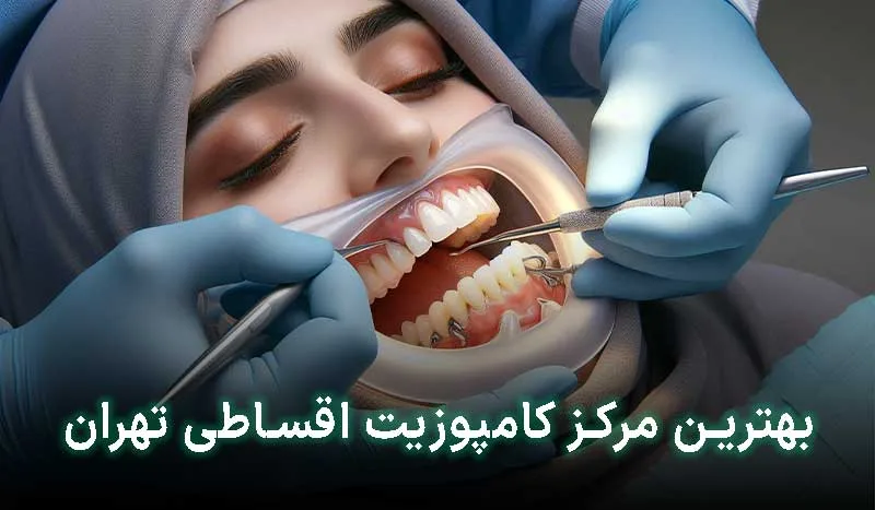 5 تا بهترین مراکز کامپوزیت قسطی تهران +آدرس، تلفن