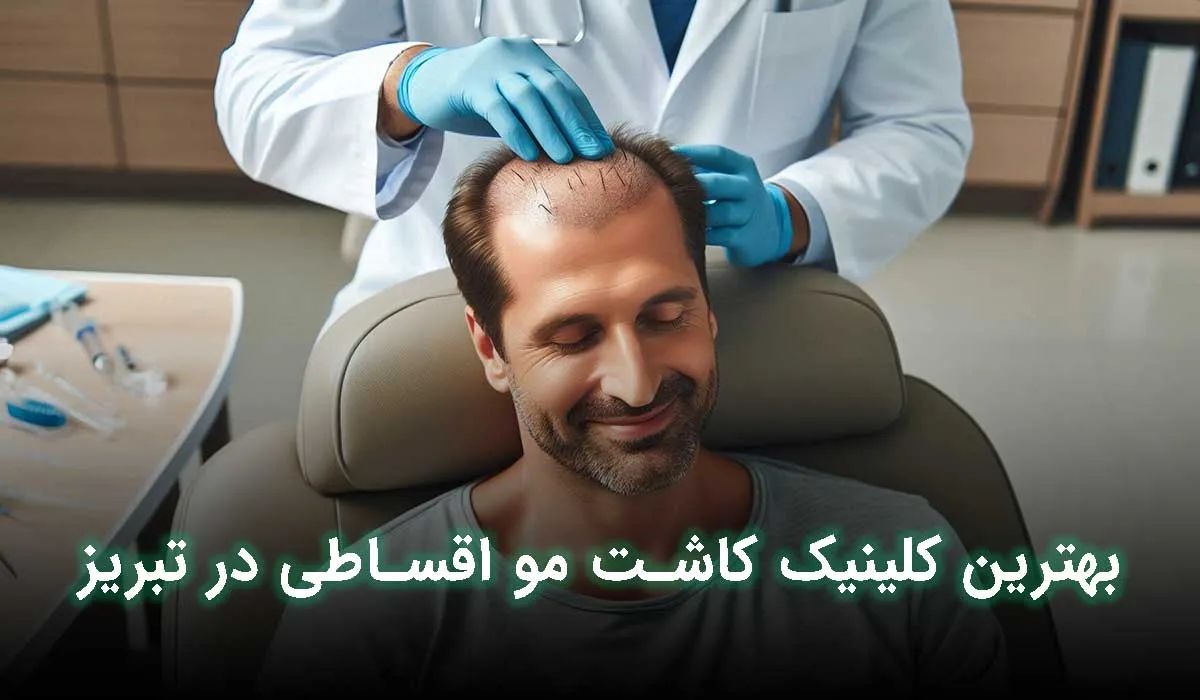 5 تا از بهترین کلینیک های کاشت مو اقساطی در تبریز+آدرس، تلفن