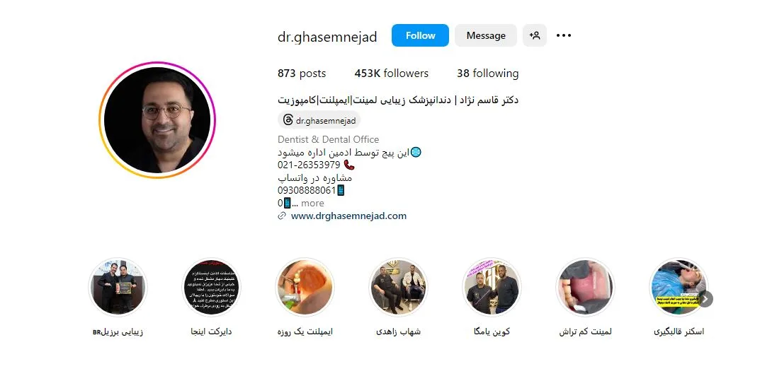 لمینت اقساطی در تهران