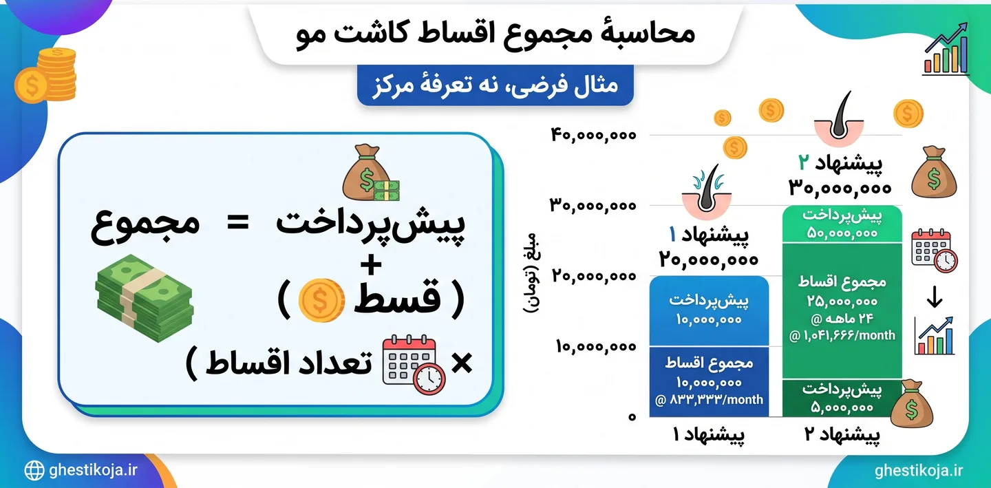 کاشت موی اقساطی در ایران؛ پیش‌پرداخت، اقساط و هزینه‌های درمان