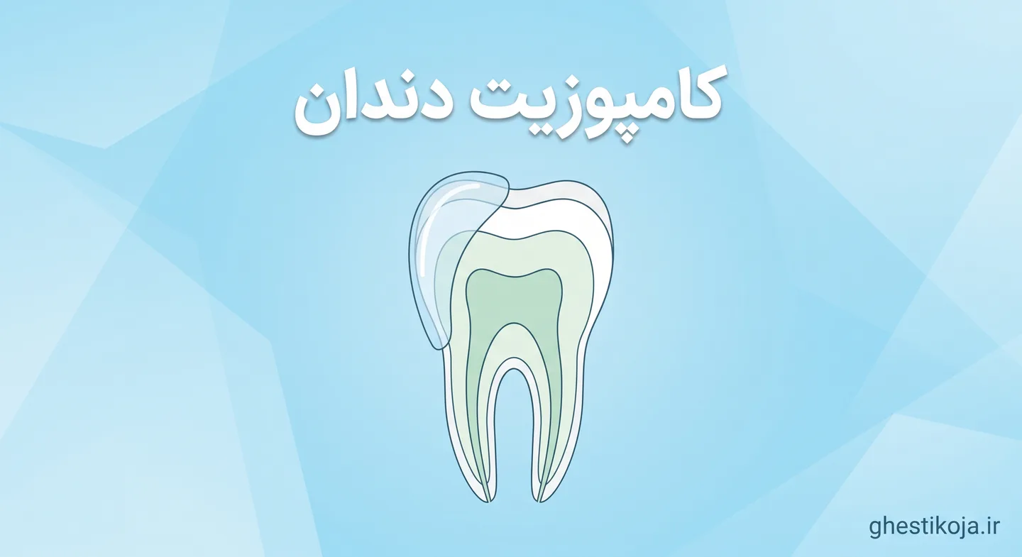 کامپوزیت دندان اقساطی؛ بررسی هزینه و شرایط پرداخت