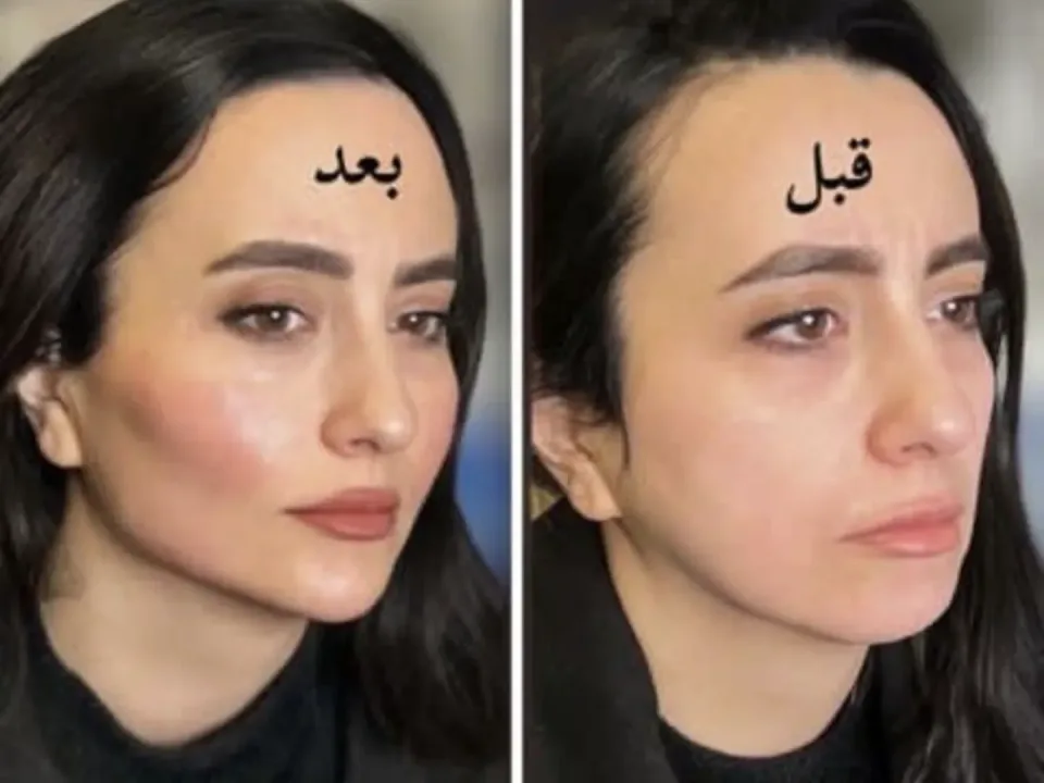 کـلینیــک زیـــبایی لنـــــــا