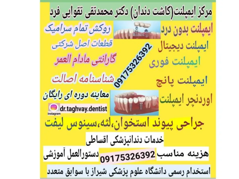 دندانپزشکی ایمپلنت دکتر تقوایی فرد - 1