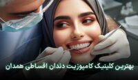 کامپوزیت قسطی در همدان